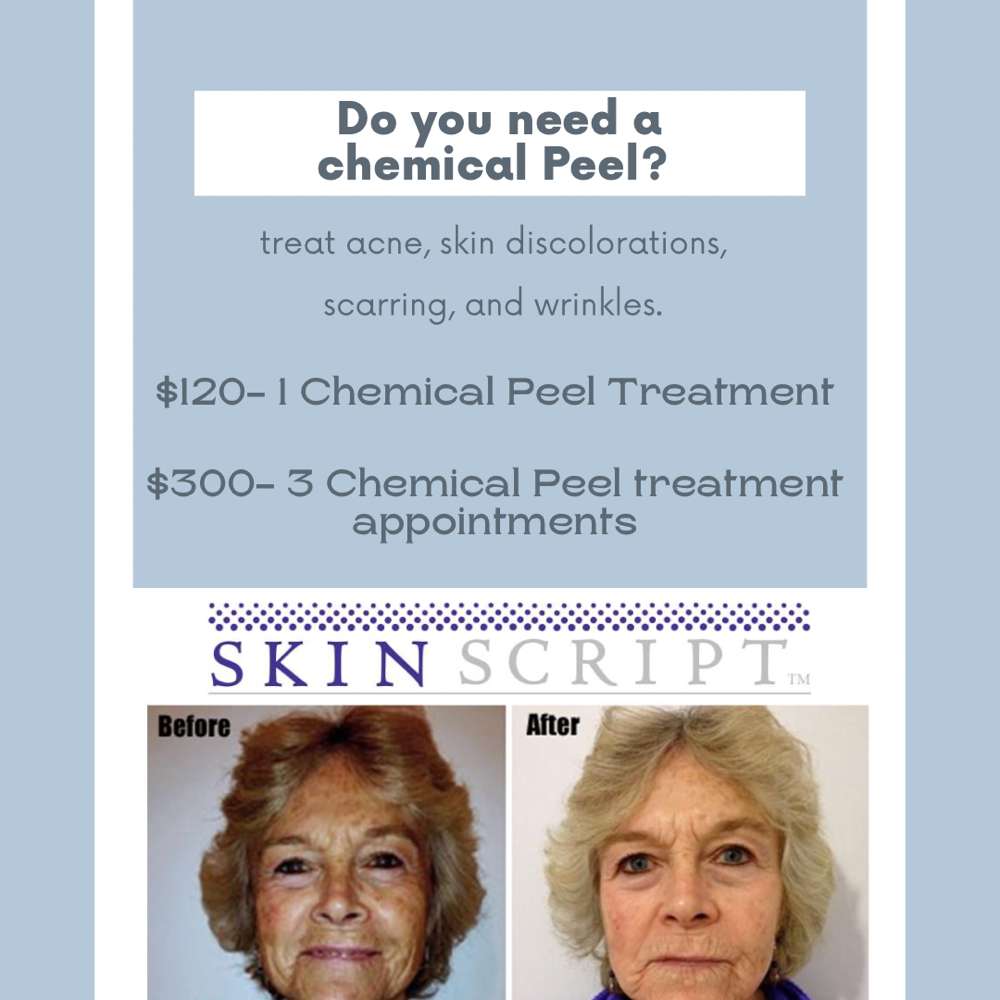 Chemical Peel