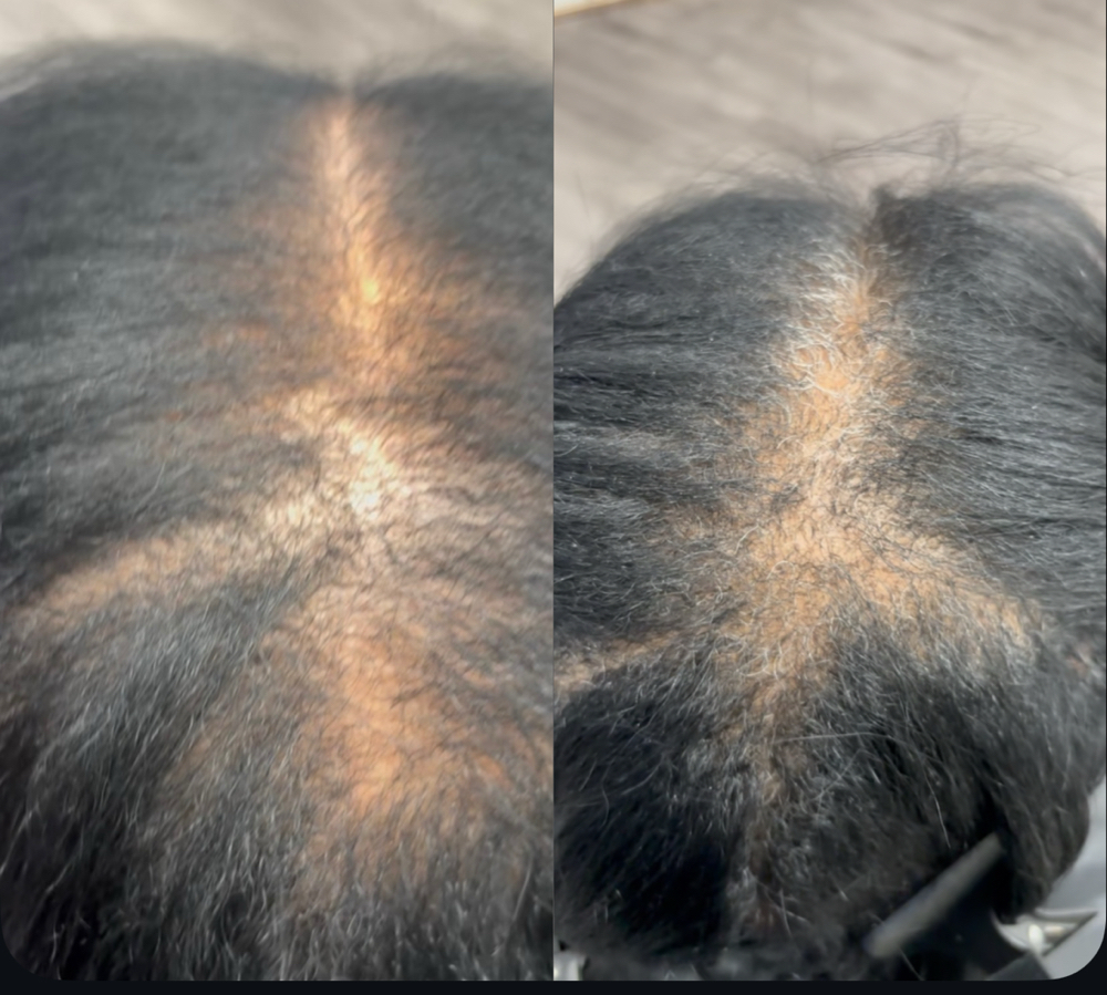Root Retouch (Gray Coverage)
