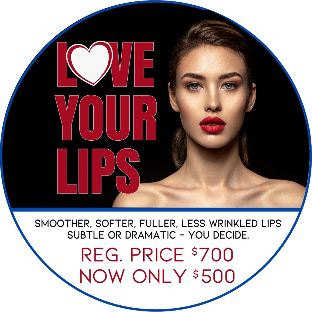 ON SALE - LIP FILLER