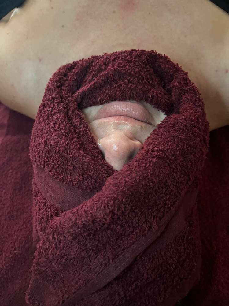 Custom Halo Facial