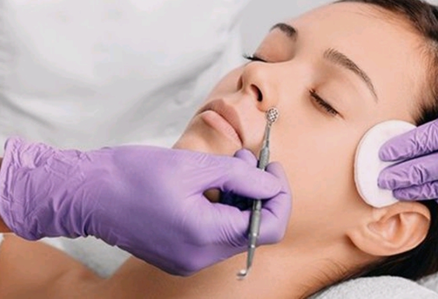 Facial With Extractions