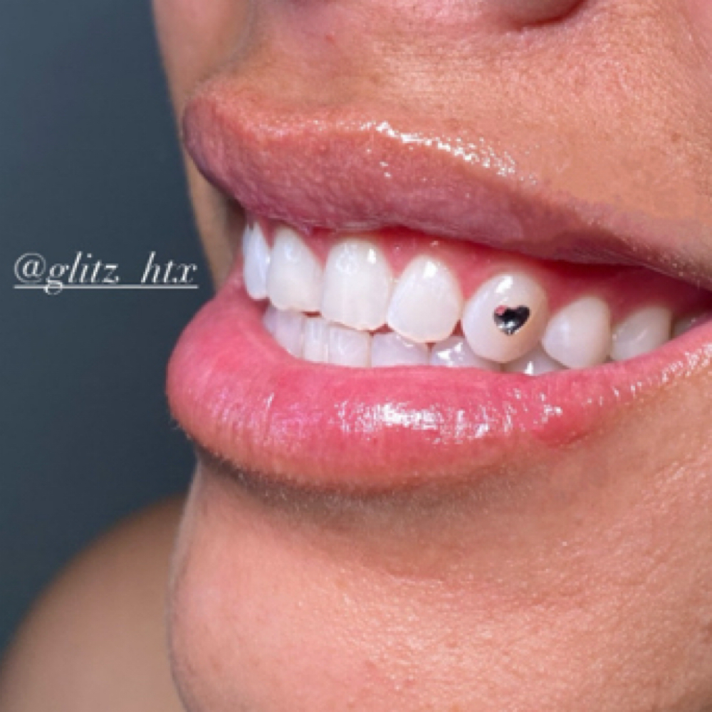 Teeth Gems at Glitz_Tx in San Antonio, TX