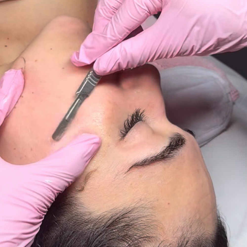 Dermaplane at Peachy Queen Waxing Lounge in Aurora, CO