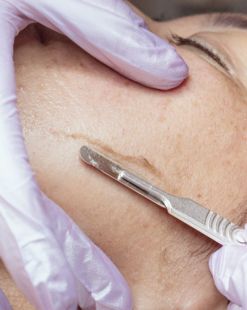 Dermaplaning Facial at Botanique skin club in LA HABRA, CA