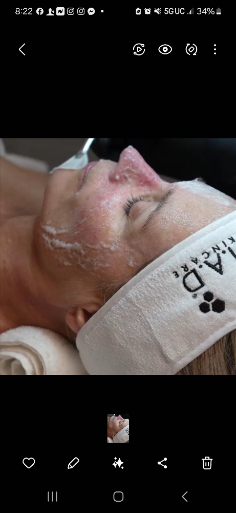 CARBONETIX Facial