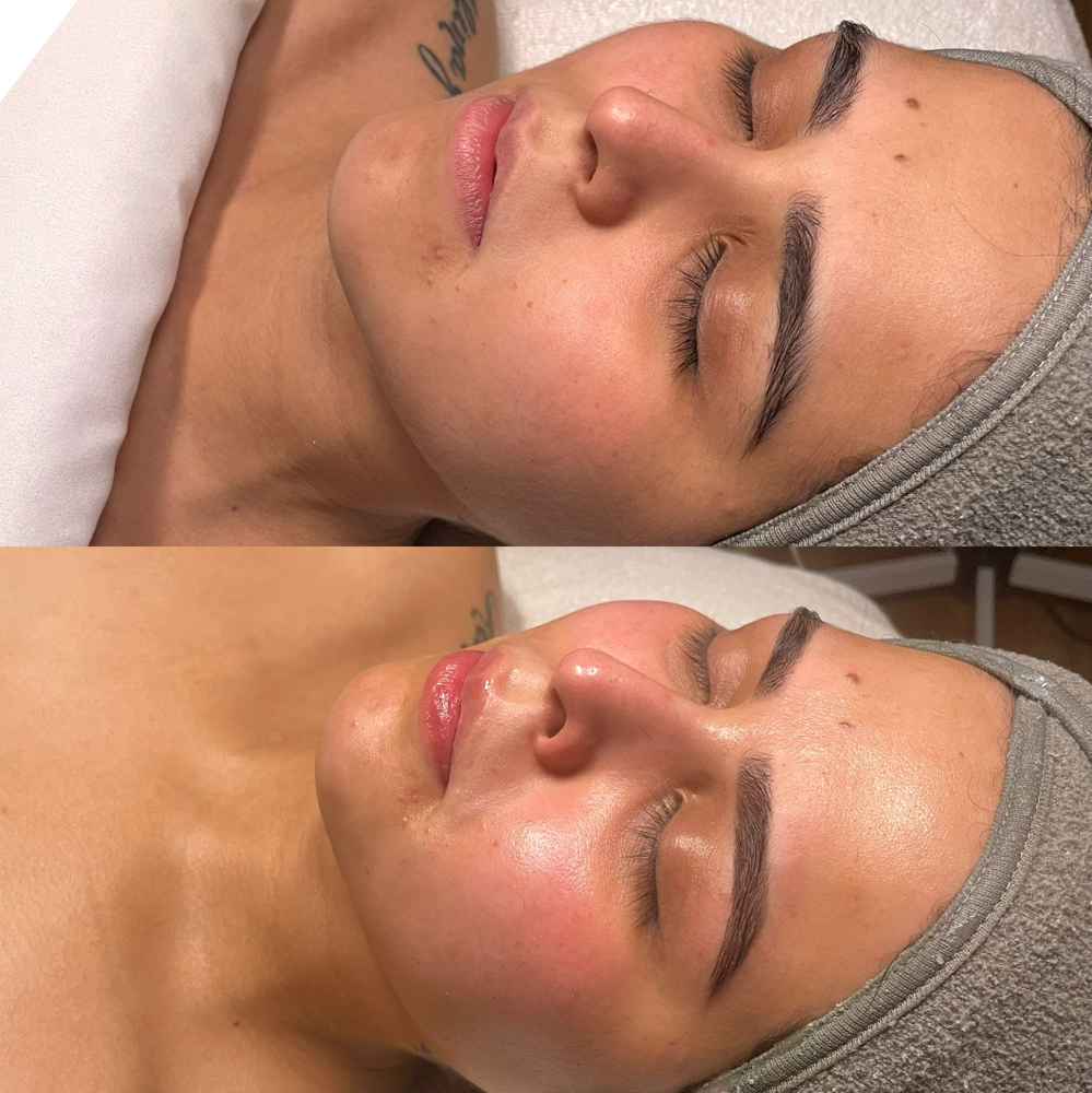 Deluxe Dermaplaning Treatment