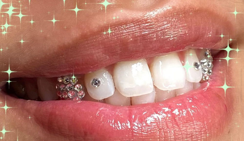 Solid Sparkle Tooth