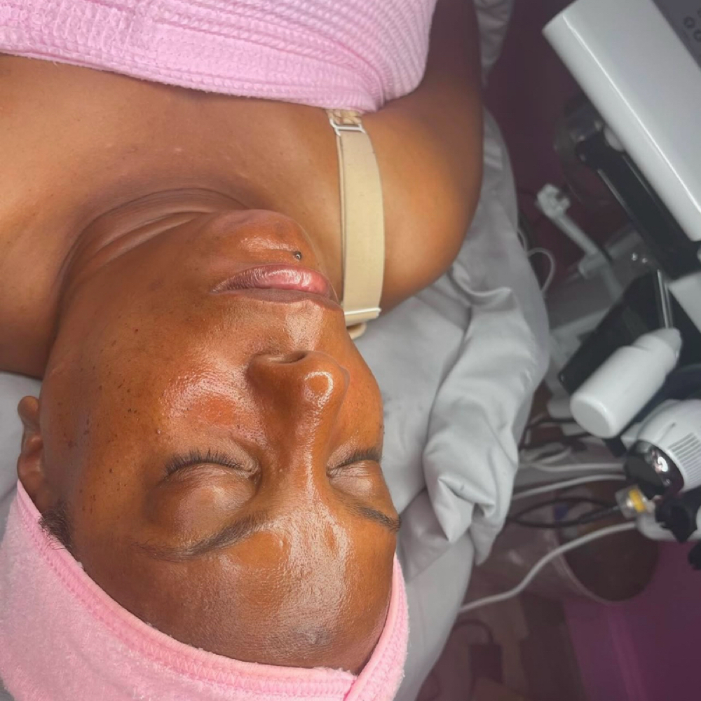 Summer Glow + Hydradermabrasion at Clinical Complexions in Merrillville, IN
