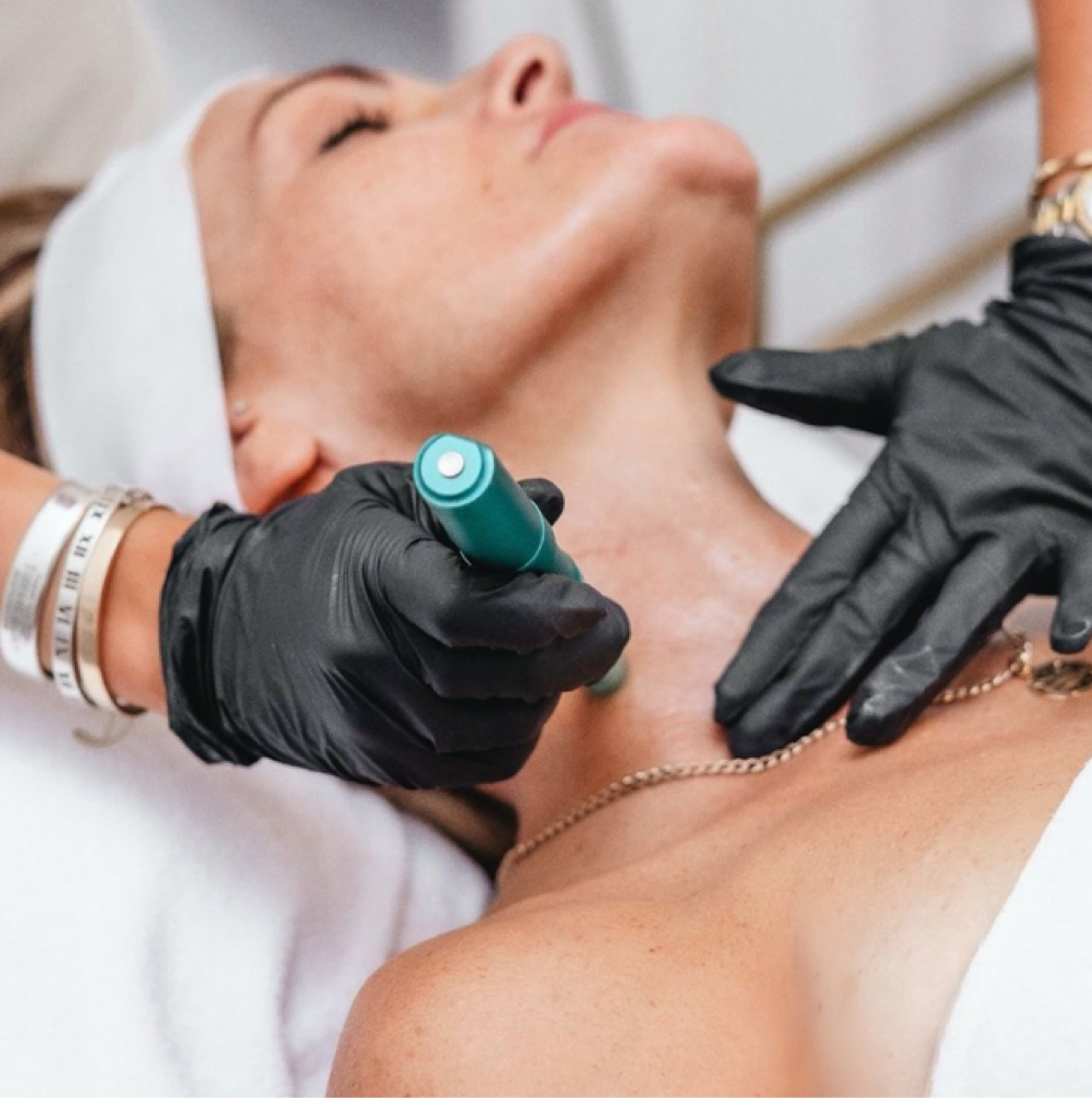 Microneedling Neck at Vogetica Beauty Lab (Regina) in Dallas, TX