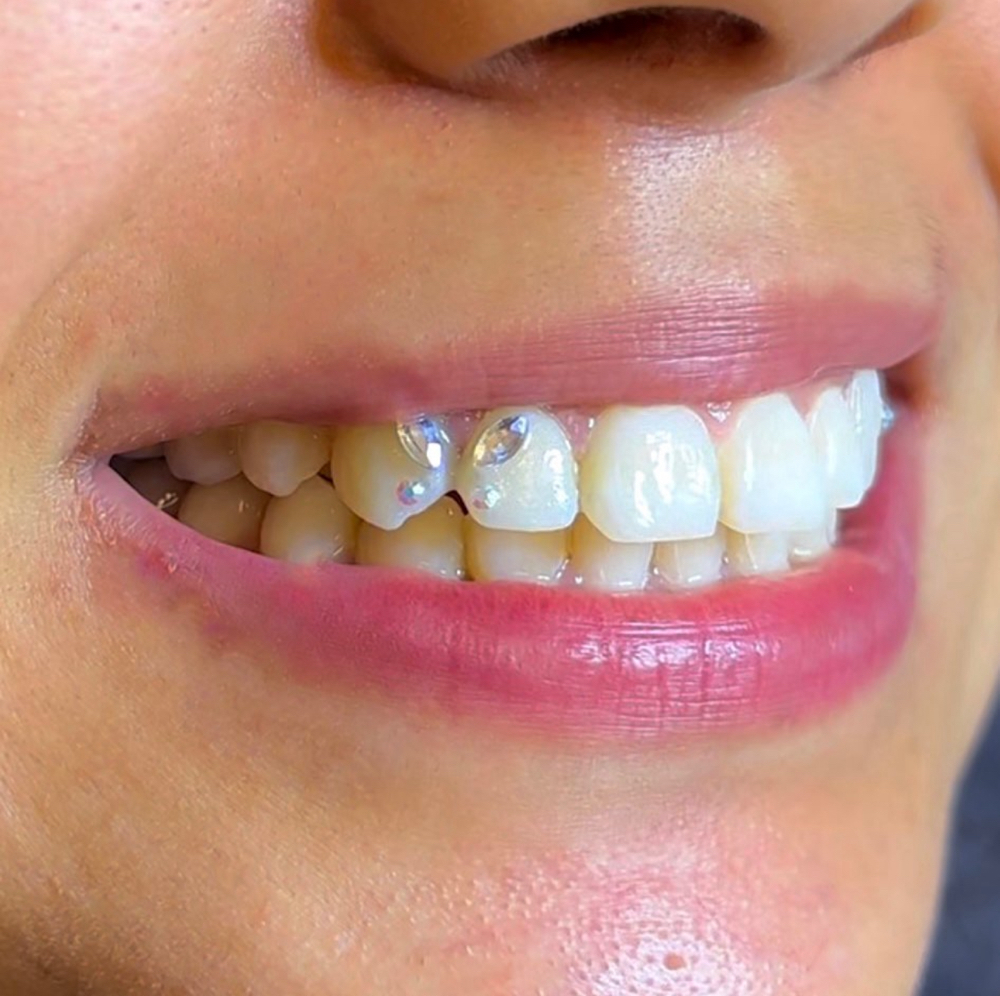 Butterfly Design Tooth Gems