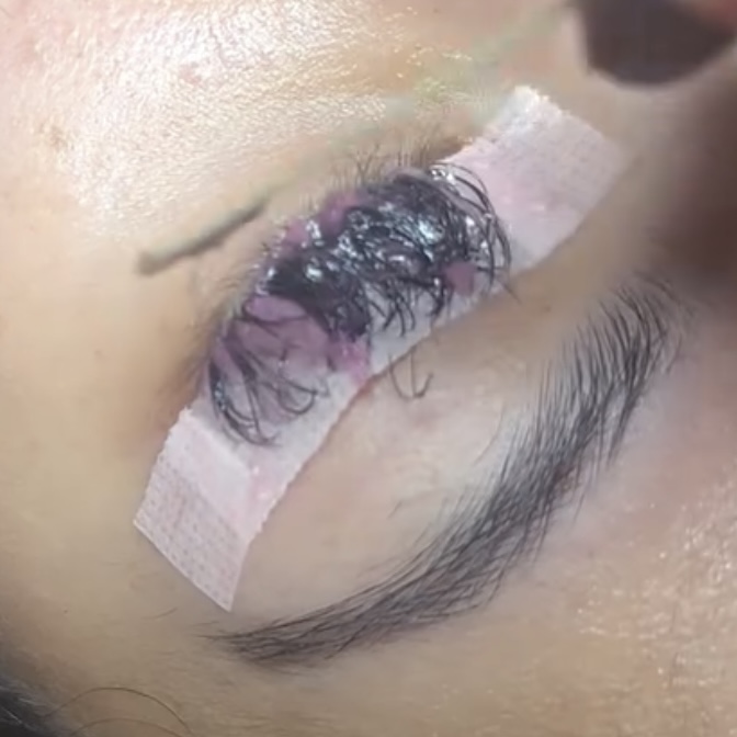 Lash Removal