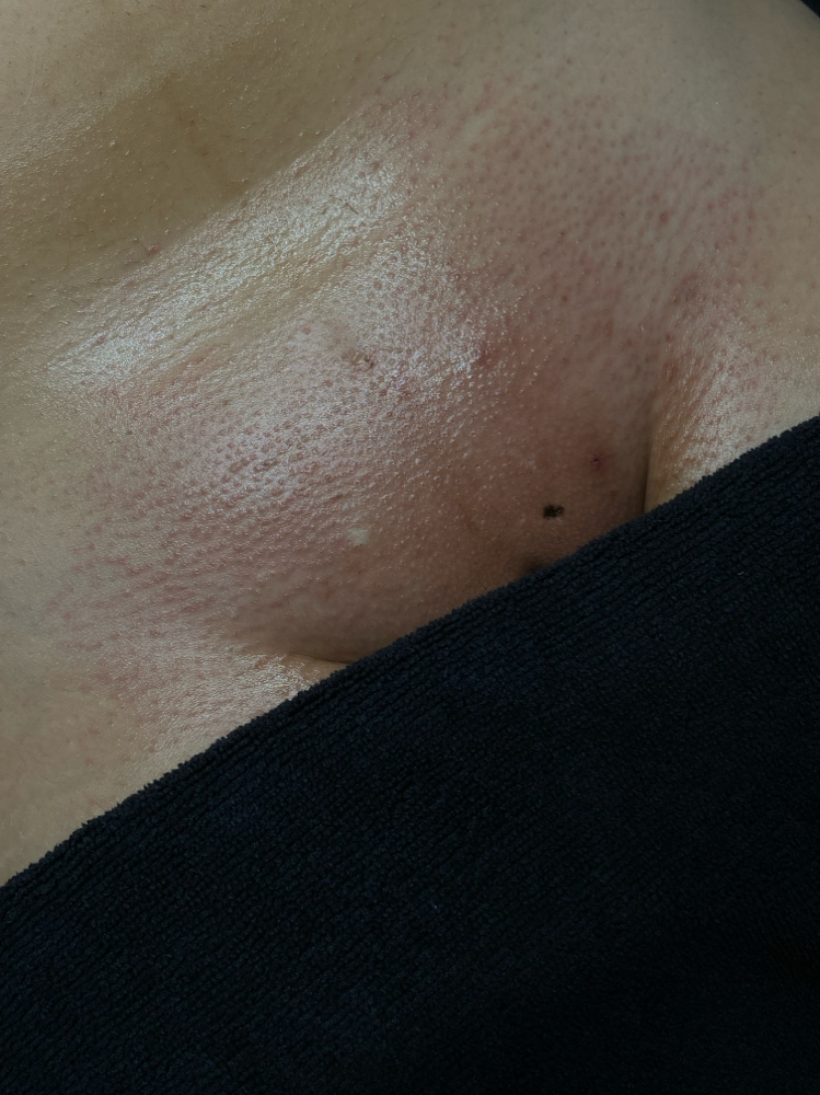 Brazilian Wax