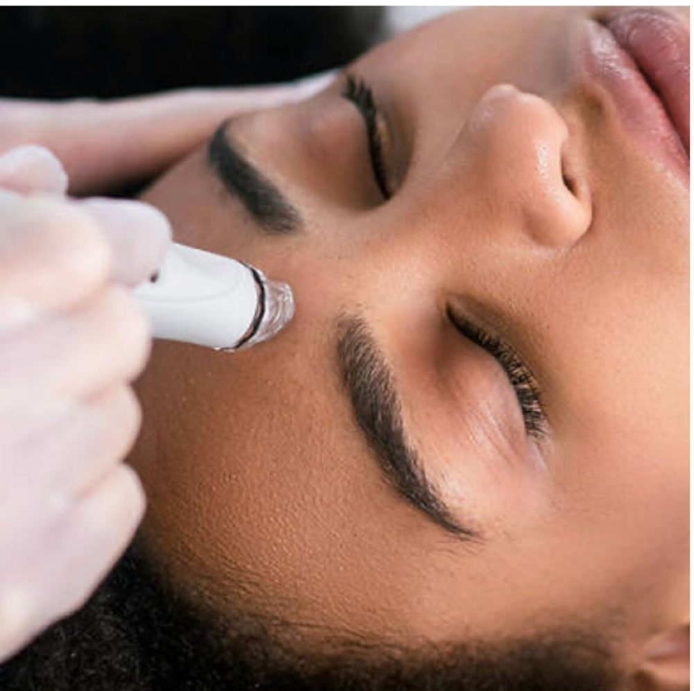 Microdermabrasion Facial at Gardenias Beauty Salon in North Charleston, SC