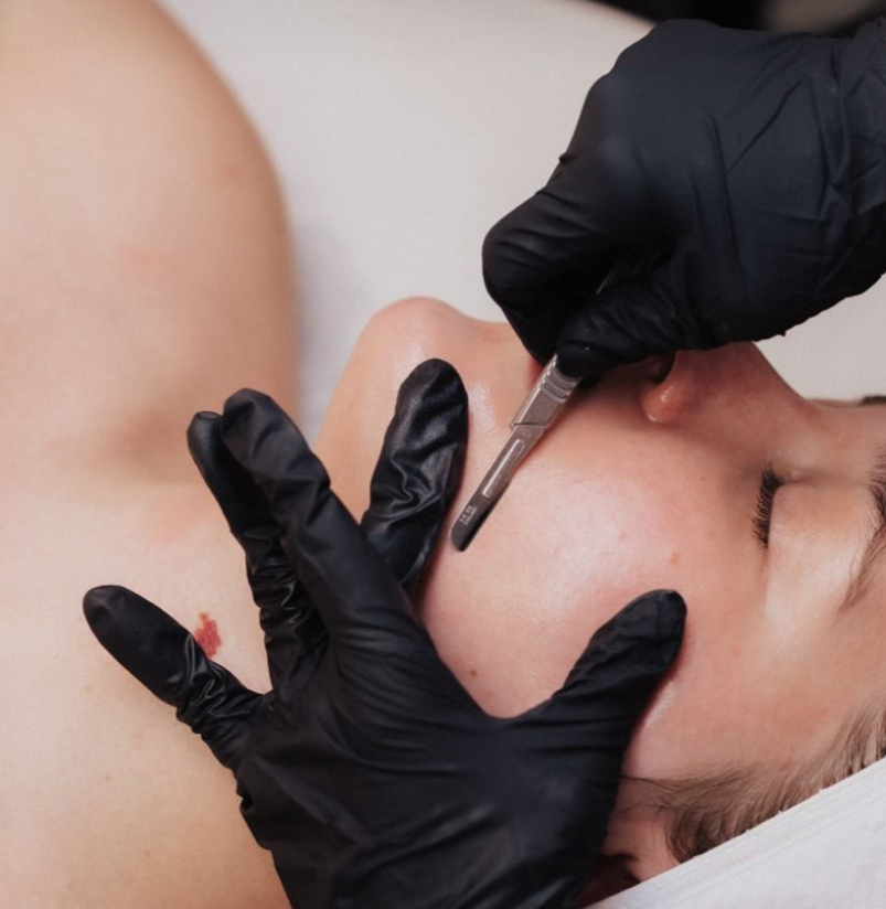 Dermaplane Pro Facial