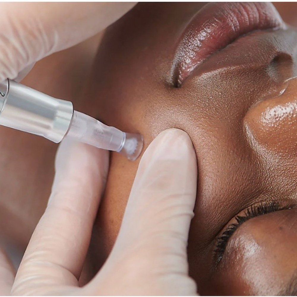 Glass Skin Infusion Therapy at Glow & Behold in Durham, NC