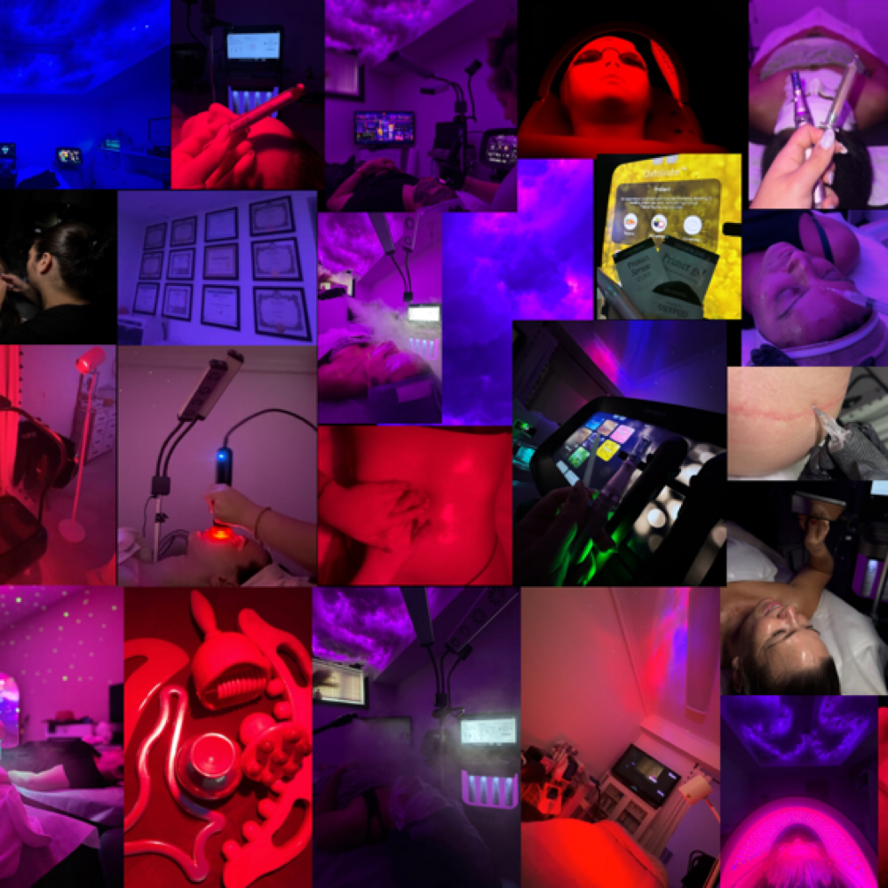 Microneedling at SKINISHNYC in Bayside, NY