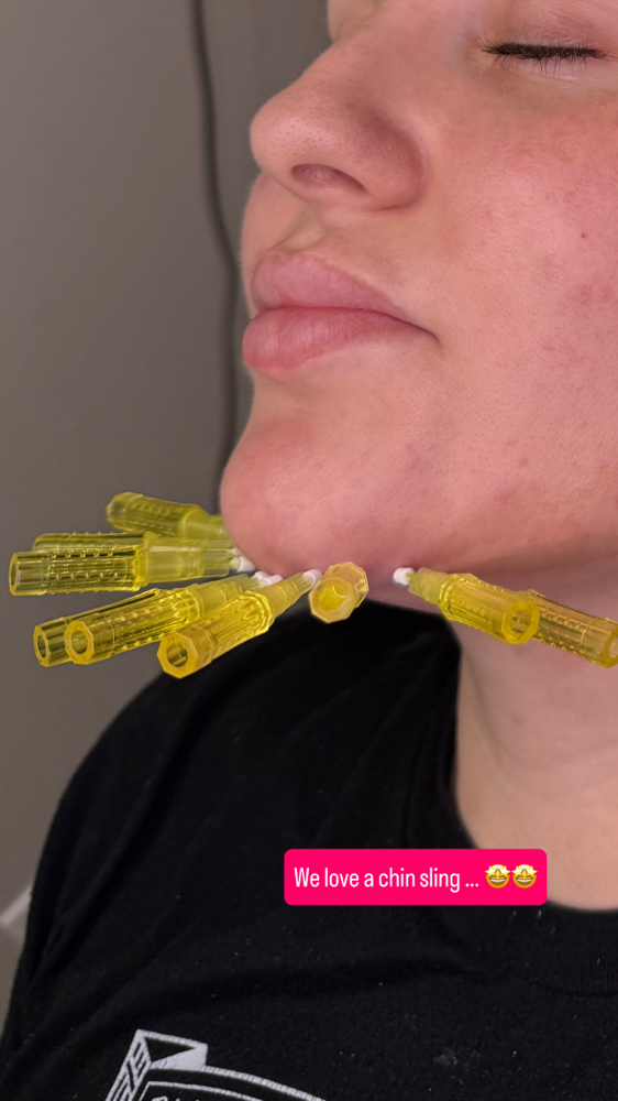 Chin Sling