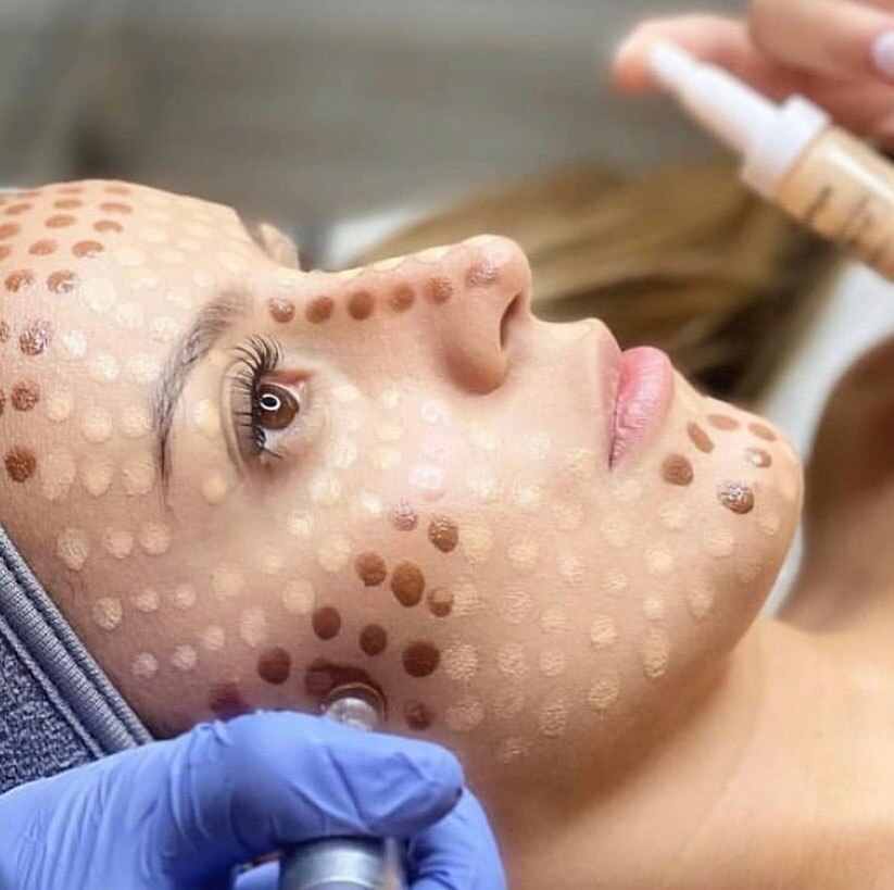 BB Glow Full Face Treatment Facial