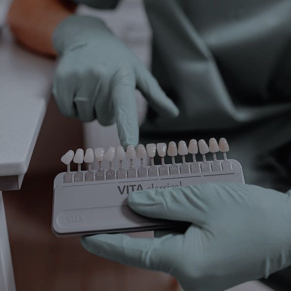 Teeth Whitening