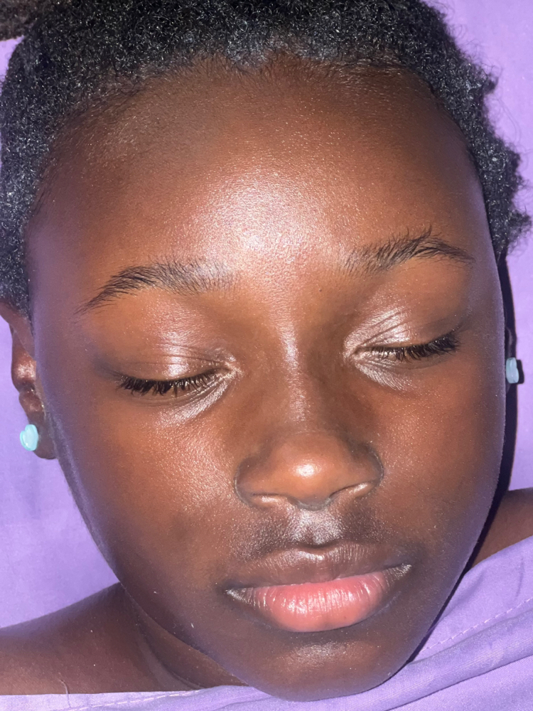 Tween/Teen Acne Facial