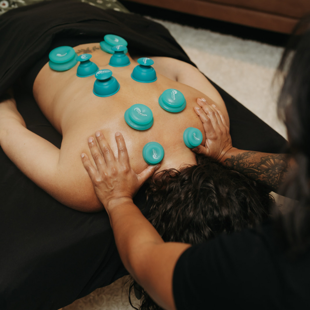 Cupping Therapy at Relax & Restore with Rosie in Palmetto, FL