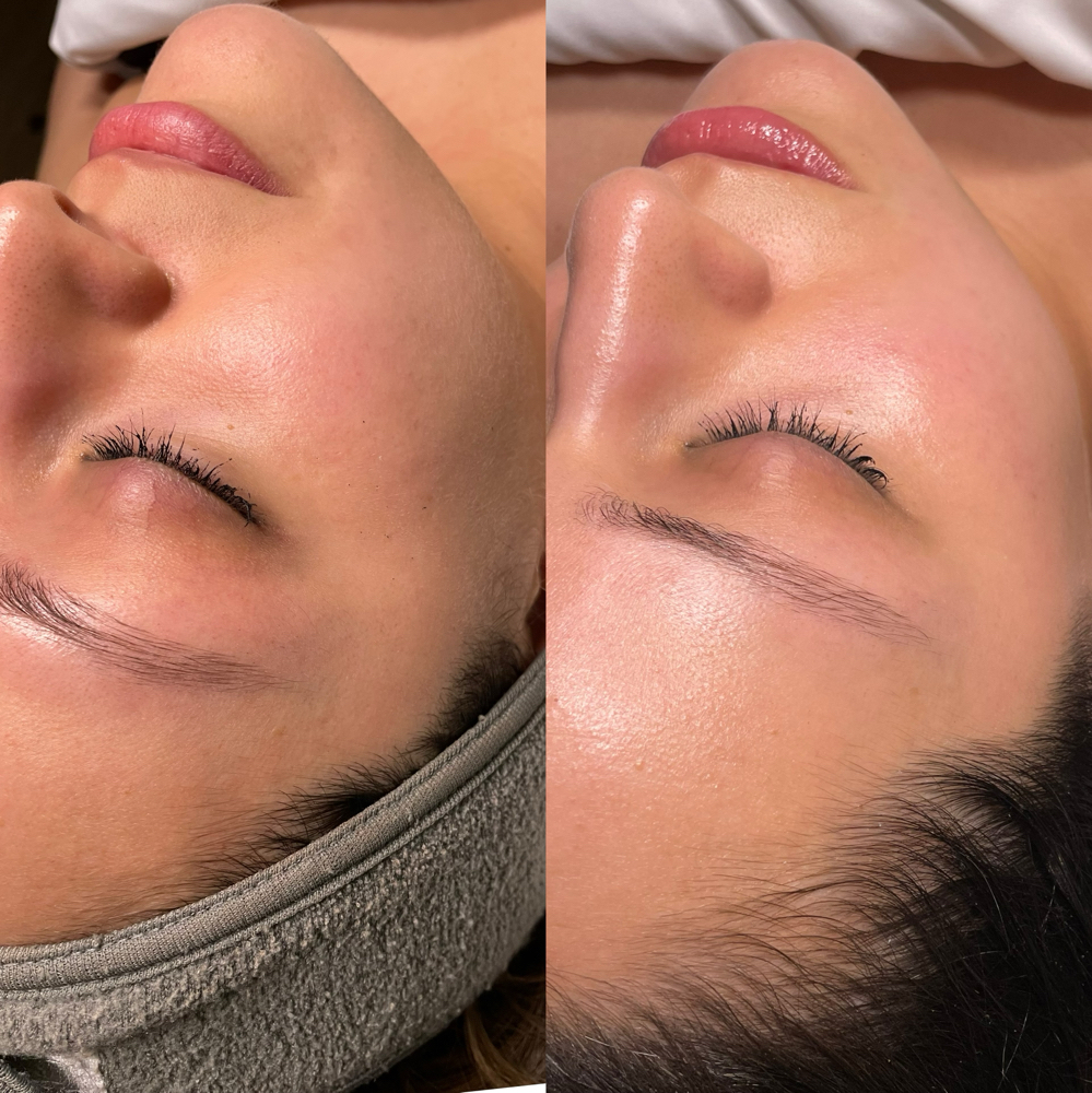 Just Peachy Dermaplaning Facial