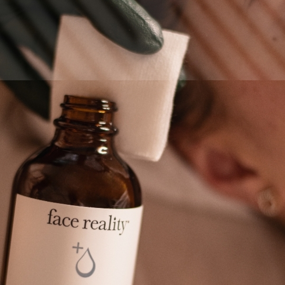 Acne Peel (Existing Clients Only) at Dari Esthetics in New York, NY