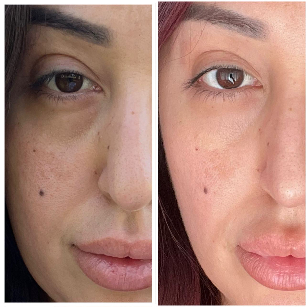 Under Eye Skin Booster