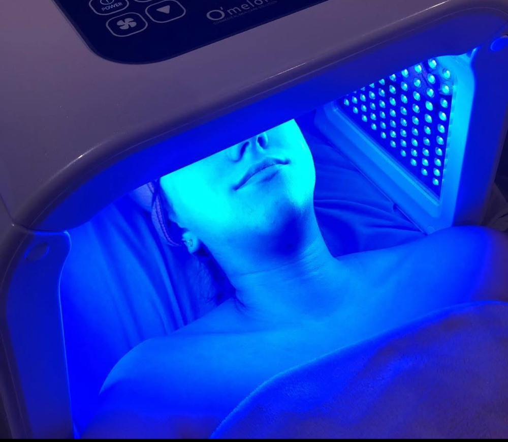 Add-On 10 Minutes LED Therapy