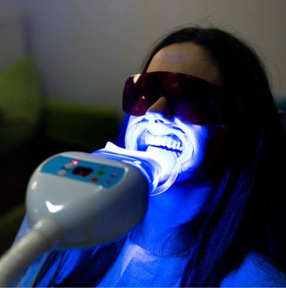 Professional LED Teeth Whitening at Luminous Glow Skin & Laser in Buckeye, AZ