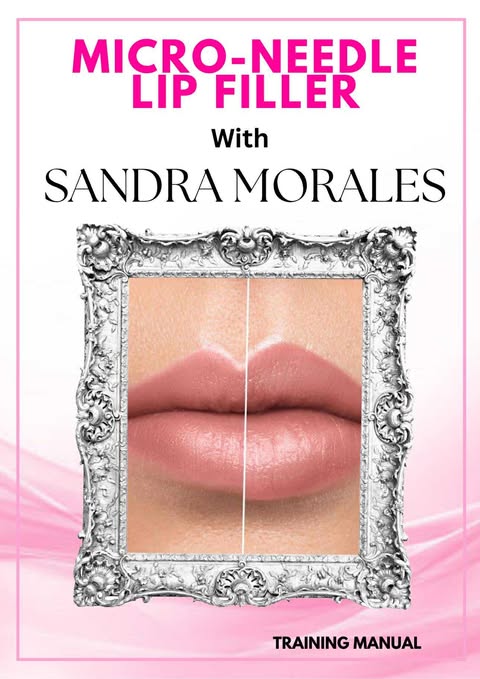 Microneedle Lip Filler Class W/Kit at Peridot Studio in Lubbock, TX