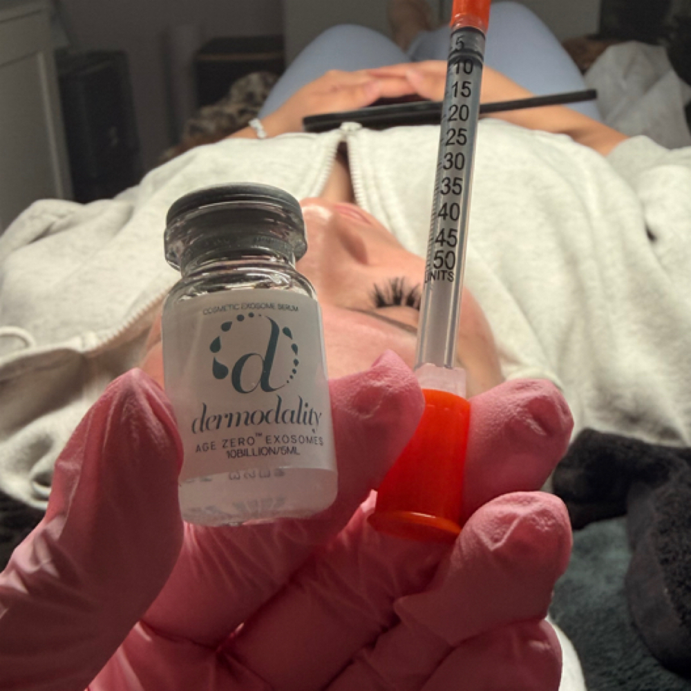 Microneedling at Isaesthetics.lv in Las Vegas, NV