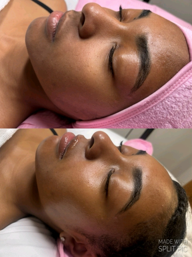 May : Dermaplane Deluxe