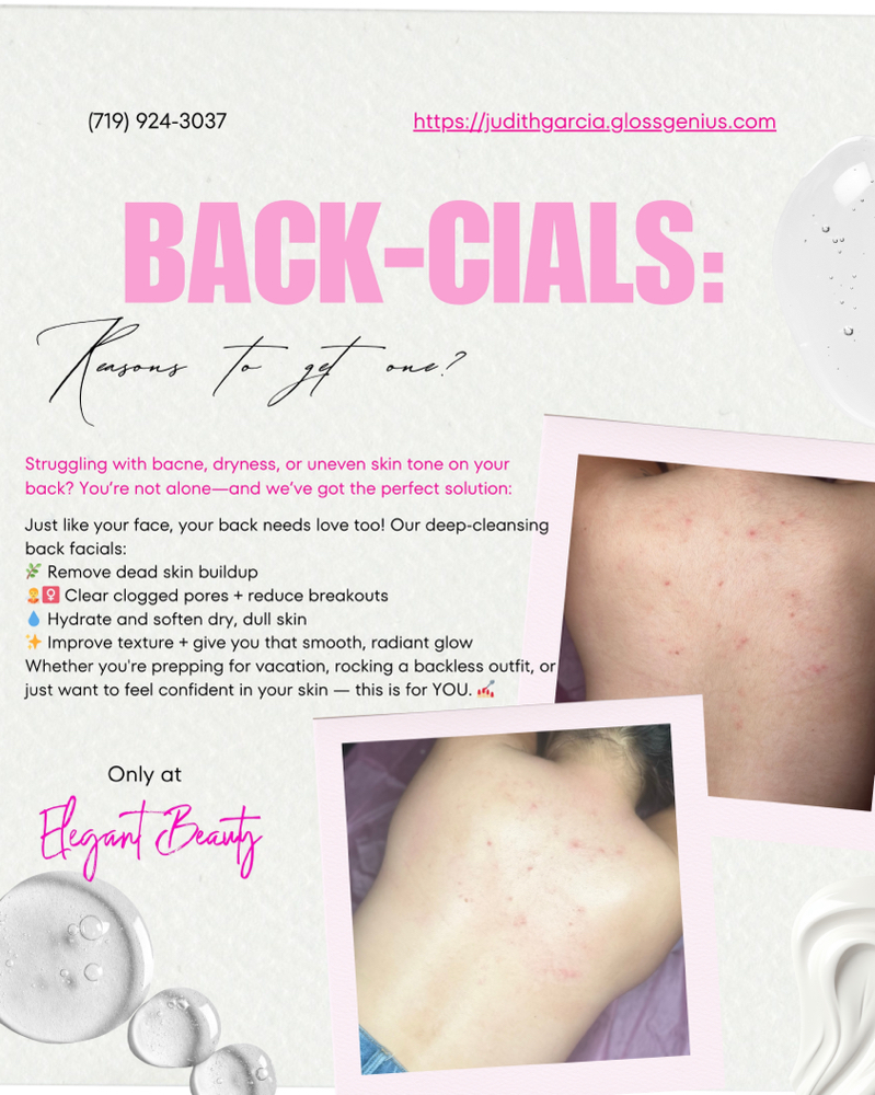 ✨BACK FACIAL:LIMPIESA DE ESPALDA✨