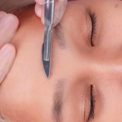 PRECISION DERMAPLANING at Delarosa Aesthetics LLC in Mobile, AL