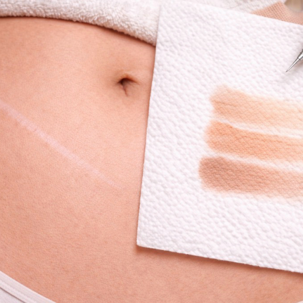 Scar Camouflage Tattoo