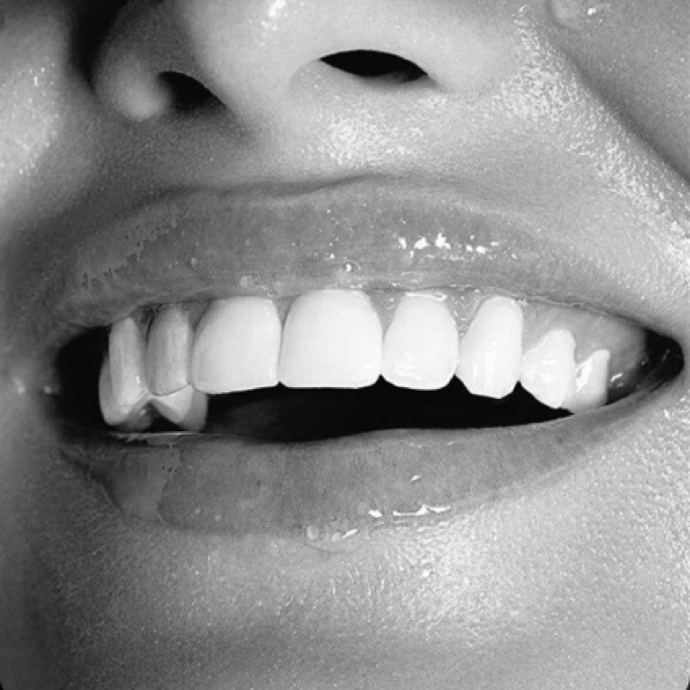 Teeth Whitening 1 Hour at Luxe Esthetics in 95688
