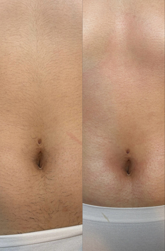 Belly Wax