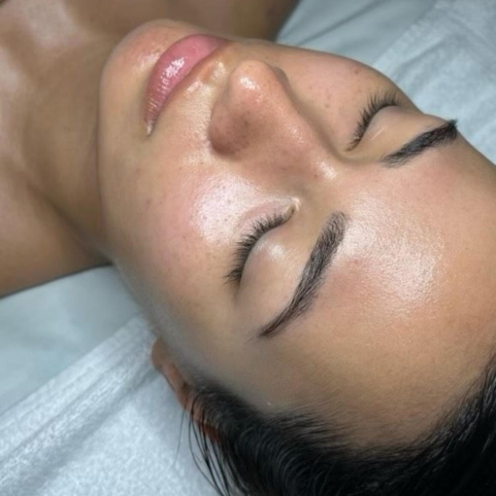 Chemical Peel Series at Esther-tician in Ridge, NY