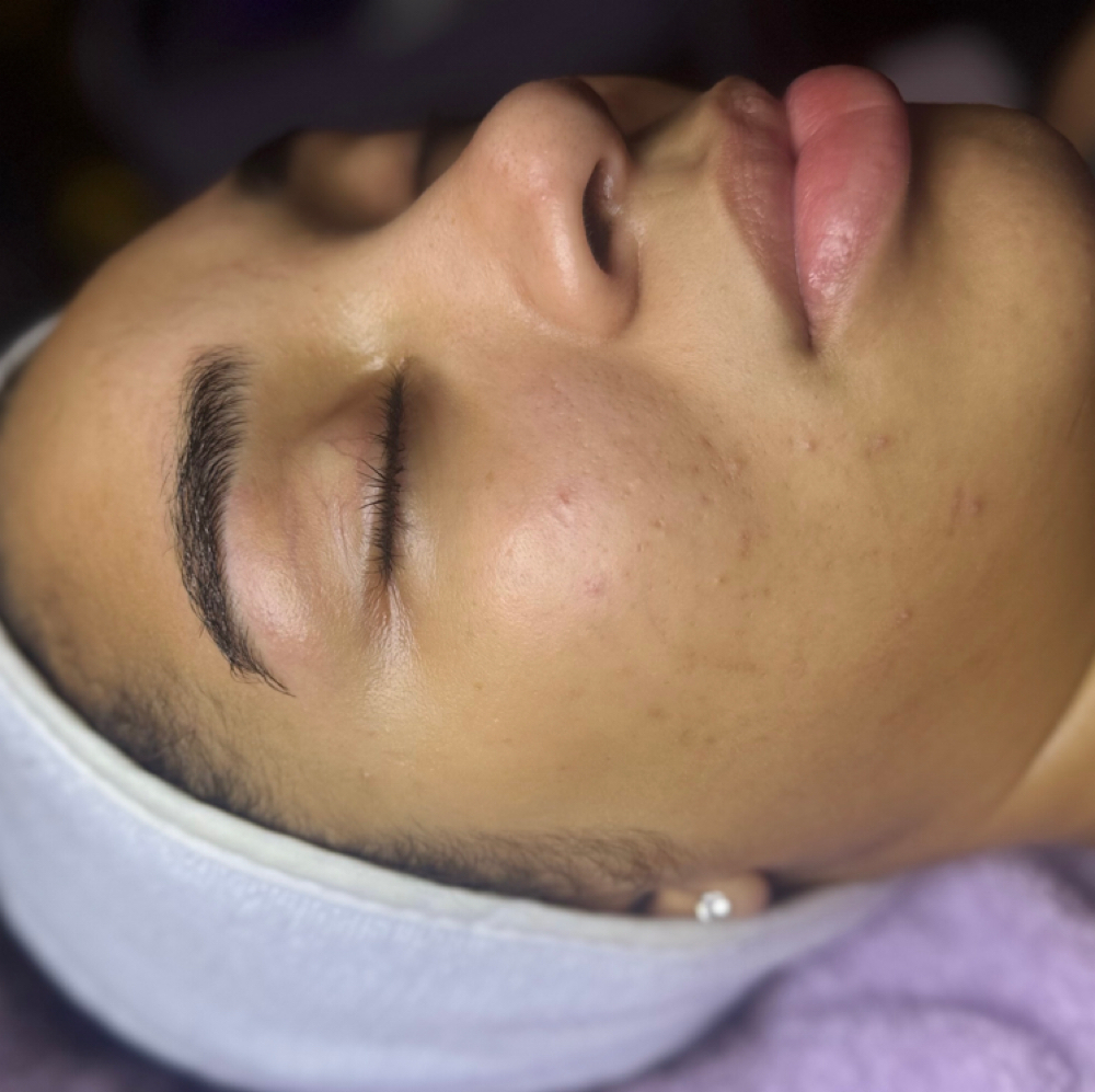 Express Facial 30MINS at Danae Esthetics in Center Line, MI