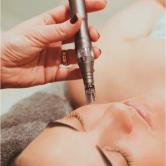Revitapen Enhancement Add On at Ingrid Thompson Skincare in Beverly Hills, CA