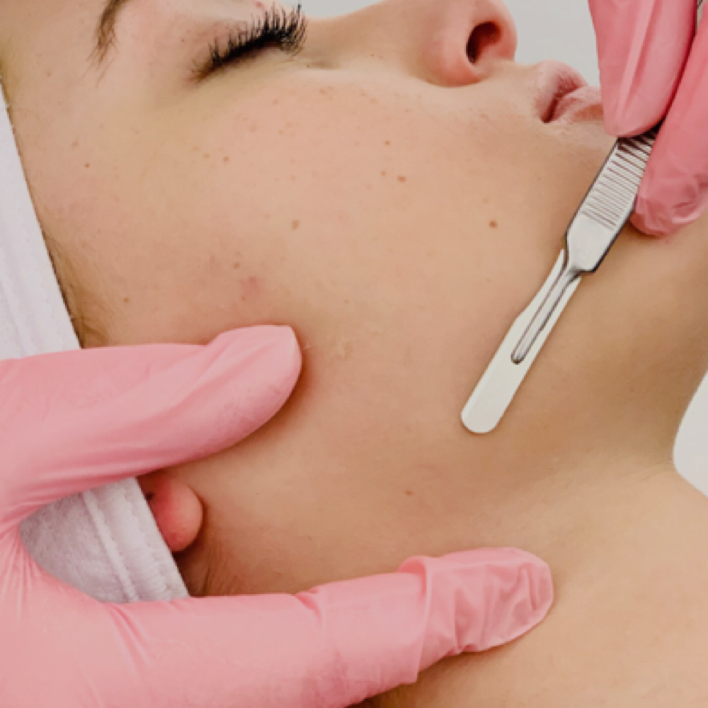 Dermaplane Facial at Simply Skin LLC in Carson City, NV