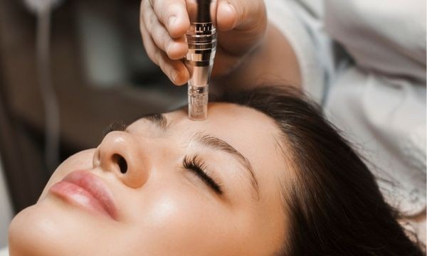 Microneedling Facial