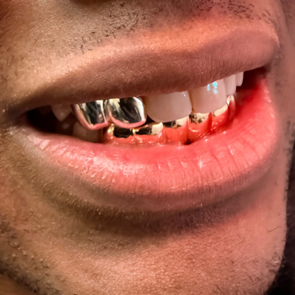 Grillz Pick Up at Jem Junkies