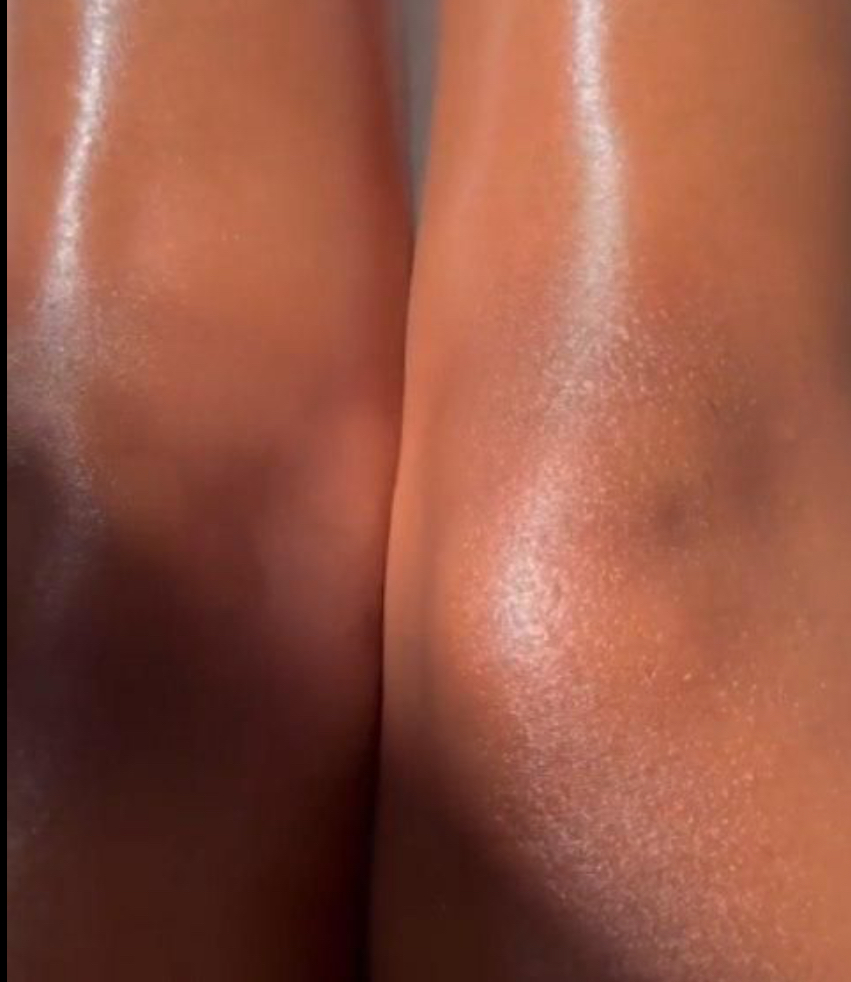Knees