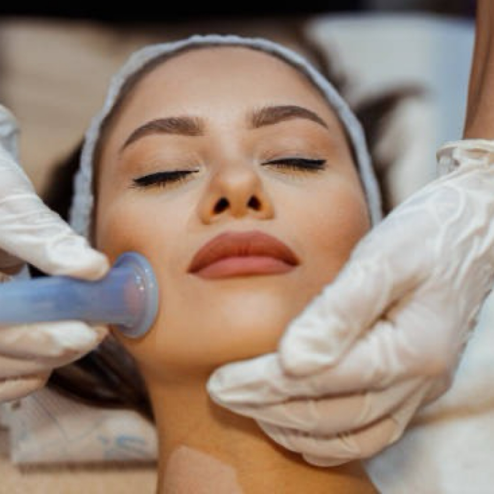 Facial Cupping at Dermalove Aesthetics in Portland, OR