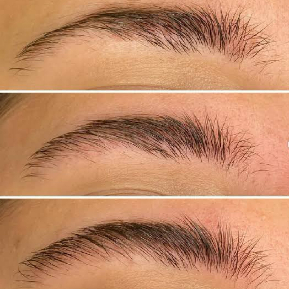 Brow Restoration Therapy at KC Aesthetics Studio in Westport, CT