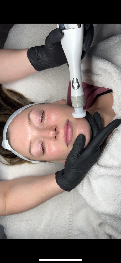 Jet Plasma Treatment 1 Of Series