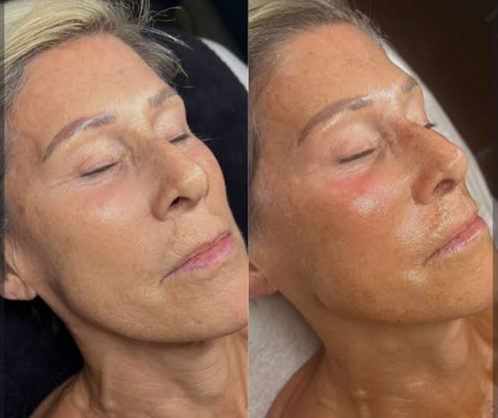 Fountain Of Youth Treatment