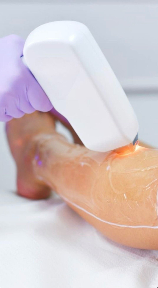 Laser Hair Removal-Legs at Aurora Glow Aesthetics in Spring, TX